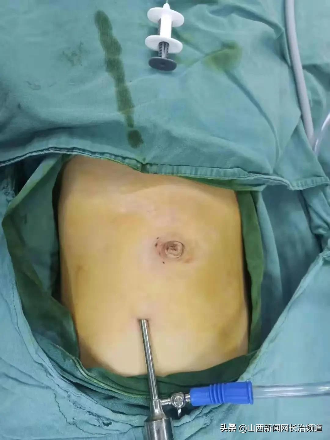 什么樣的疤痕不能當兵？深入了解征兵體檢中的疤痕要求，征兵體檢中的疤痕要求，哪些疤痕影響入伍資格？