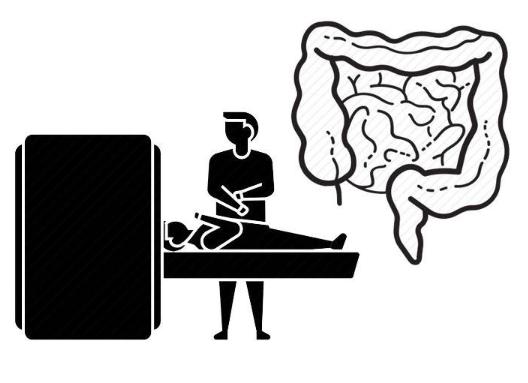 腸癌的早期癥狀及其識(shí)別重要性，腸癌早期癥狀識(shí)別與重要性探討